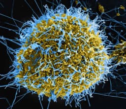 Ebola pandemic in 2026?