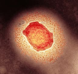 10+ monkeypox cases in US by October 31?