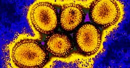 100+ Bird Flu cases in U.S. before February?